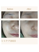 ファミル(FAMIL)/