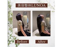 美容整体LUNOA　神戸三宮院/[三ノ宮/美容整体/整体/肩こり]