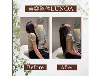 美容整体LUNOA　神戸三宮院/[三ノ宮/美容整体/整体/肩こり]