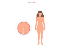 ニコ(nico)/Iゾーン脱毛