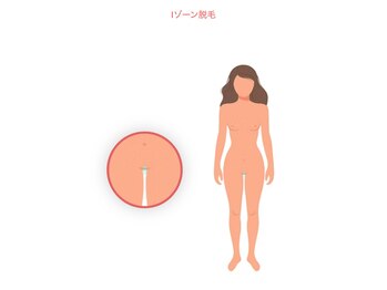 ニコ(nico)/Iゾーン脱毛