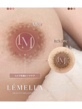 エルビービュティーサロン(LB BEAUTY SALON)/【ルメラ乳輪】実績数関西1★