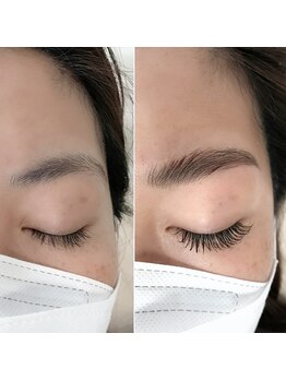 アマリリス(Amaryllis)/ハリウッドブロウリフト(HBL)