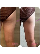 リエット(Lieto)/太ももスッキリします☆