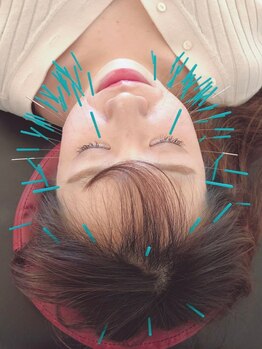 国分町鍼灸サロン/美容鍼