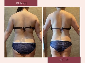 ドットカノア(.Kanoa)/お客様のbefore/after