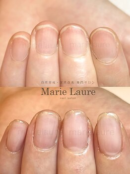 マリーロール 梅田店(Marie Laure)/深爪矯正/自爪育成/自爪風