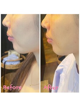 アディクト(Addict)/Before＆After