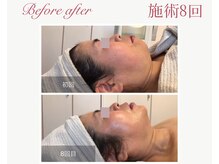 パルタージュ 三宮(Partage)/フェイスラインアップ