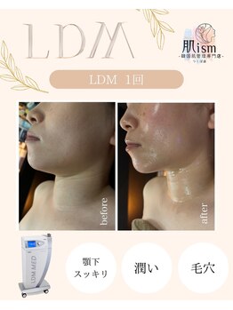 肌イズム つくば店(肌ism)/【before＆after】LDM