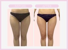 アコガレコガオ 青森店/