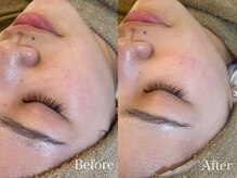 トム(Thom)/艶肌wax+ハイドロジェリーマスク