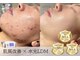 アルフォービューティー 恵比寿店(ALU for beauty)の写真