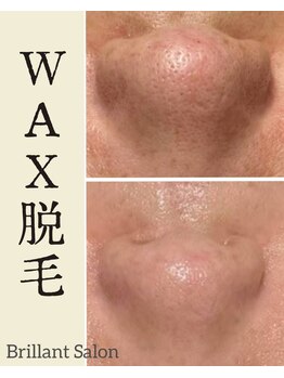 ブレリアントサロン 池袋店(brillant salon)/Wax脱毛