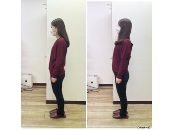 ナチュリカ(Naturica)/☆姿勢改善例☆