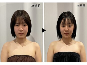 レミュー(Les mieux)/むくみ知らずの顔へ！