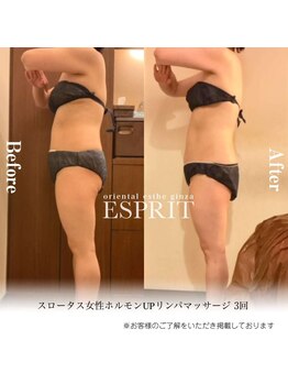 エスプリ 新宿店/痩身エステ新宿・スロータス