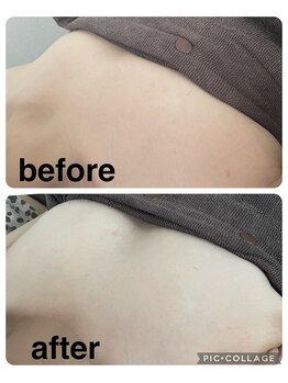 ギンザアール(GINZA R.)/お得にバストケア！