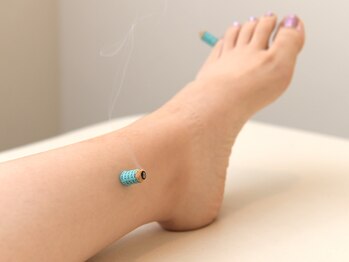 つばき接骨院/赤ちゃんがお腹の中で逆向を改善