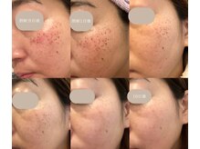 ソナ 大和西大寺院(SONA)/