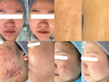 リメイク 広尾(REMAKE)/