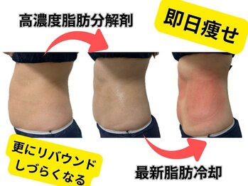 ホワイトビューティーラボ(White Beauty Lab)/高濃度脂肪分解剤で即日痩せ