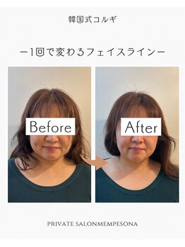 ムンプソナ(Mempesona)/ビフォーアフター