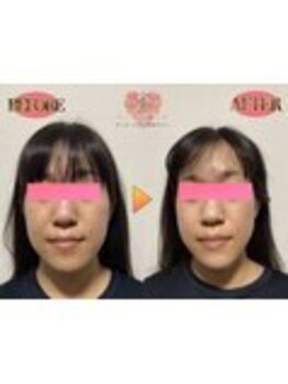 ヴィオーデ美容整体サロン 川越店/小顔、リンパ、ヘッドスパ、整体