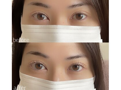 アンテイン(anthein)の写真