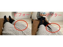 康整体院/首が下向きにくい理由