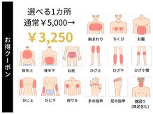 ステイゴールド 新百合ヶ丘(STAY GOLD)/選べる1ヶ所脱毛