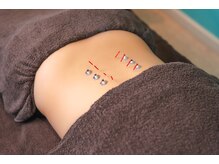 ビアンカ 鍼灸サロン川崎院(Bianca)/腰痛