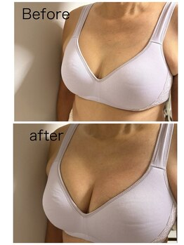 ベッピン(Beppin)/静岡バストアップ/静岡育乳