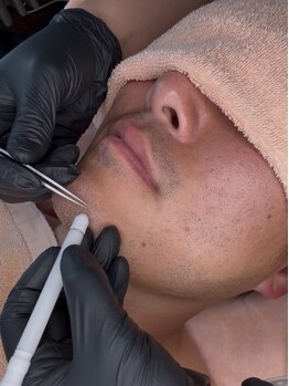 ペンナヌウク(penna nuuc)の写真/"終わりがある”美容電気脱毛◇面倒な髭&眉毛のお手入れはもう終わり★サロン通いを卒業したい方に!