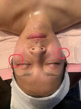 リメイク(Re:make)/リフトアップエステ