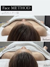 ソルヴィス(SOLVIS)/