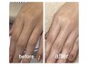 【ハンドスパ】お肌がふわふわになる♪ツヤ肌へ20分のエイジングケア