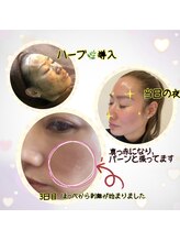 クリスタル(Crystal)/ハーブピーリング