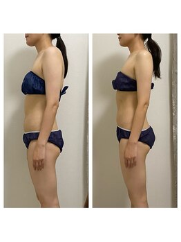 ハピネスビューティーサロン(happiness beauty salon)/WINBACK症例