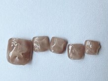 アイネイルズ 梅田店(I nails)/フットもやもやぷっくり