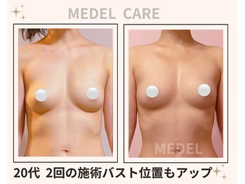 メデル 北千住店/バストアップ*育乳症例