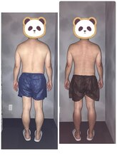 アバナ(ABANA)/メンズ痩身 | 60代男性