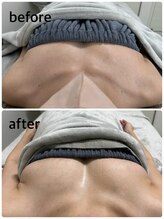 リアン(Lien)/流れたバストを元の位置へ