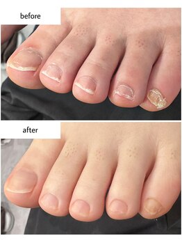 ケアプラス(care plus)/フットネイルケア