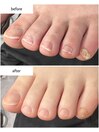 フットネイルケア