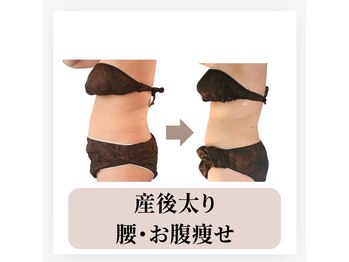 ヴィセル(VISEL)/産後ダイエット