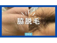 ワン(ONE)/脱毛