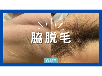 ワン(ONE)/脱毛