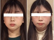 美容整体ウェリナ 中川八田院/小顔矯正/骨盤矯正/痩身整体