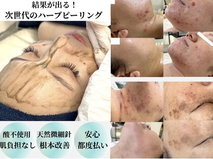 プリュボーテ(Pul Beaute)の写真